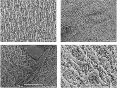 Reanalysis of historic elemental speciation filters to investigate the presence of fibrous mineral particles using microscopy techniques